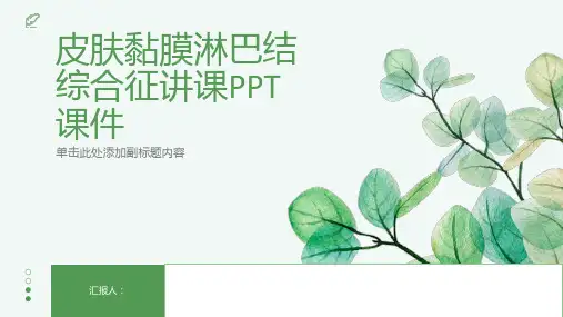 皮肤黏膜淋巴结综合征讲课PPT课件