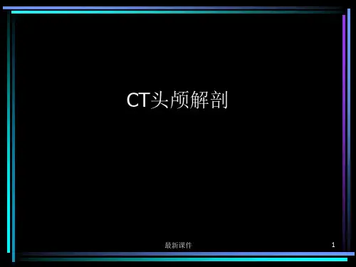 CT头颅解剖ppt课件