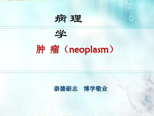 病理学与病理生理学  肿瘤