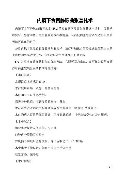  内镜下食管静脉曲张套扎术