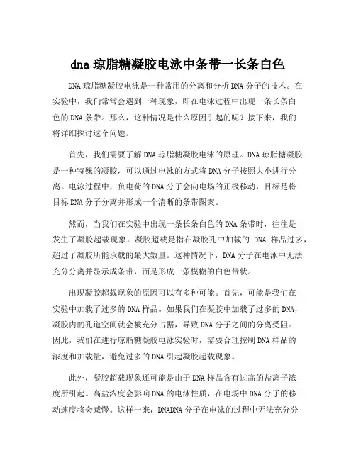 dna琼脂糖凝胶电泳中条带一长条白色