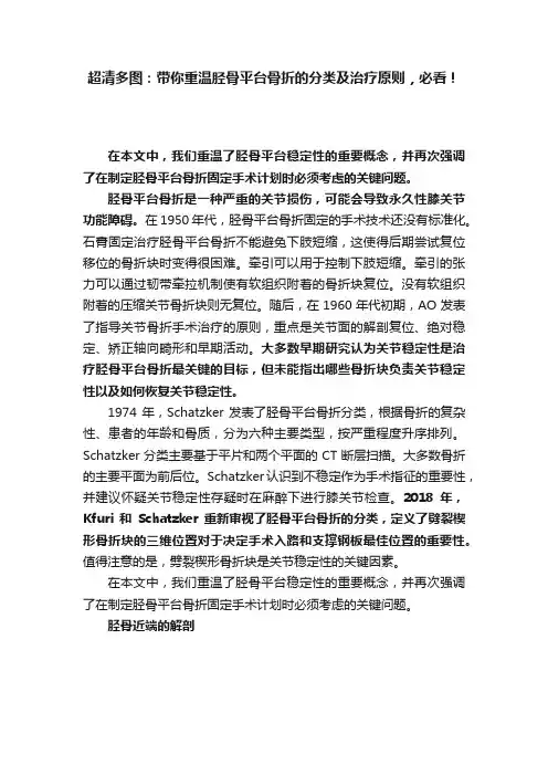 超清多图：带你重温胫骨平台骨折的分类及治疗原则，必看！
