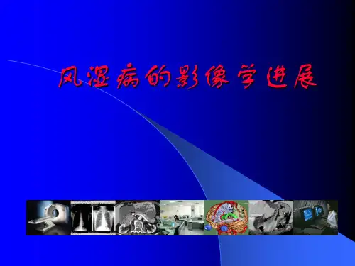 精品推荐医学影像诊断PPT课件图文详解完整版-风湿病影像学进展