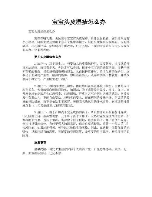 宝宝头皮湿疹怎么办