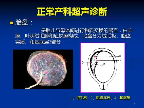 产科急诊超声诊断ppt课件