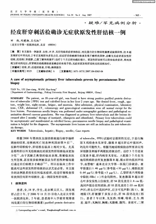 经皮肝穿刺活检确诊无症状原发性肝结核一例