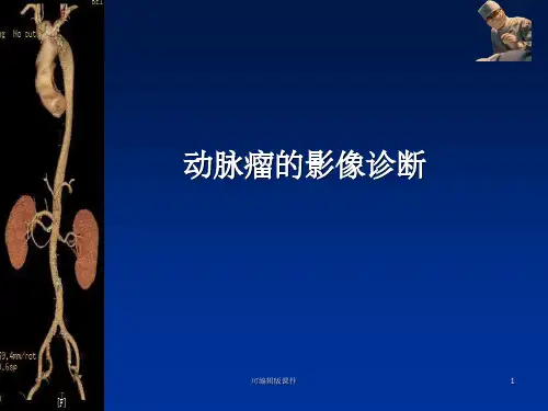 动脉瘤的影像诊断.ppt课件