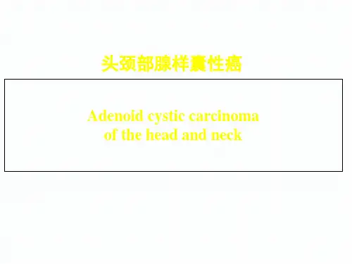 医学知识一头颈部腺样囊性癌研究进展一2017剖析