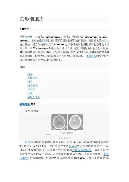 星形细胞瘤
