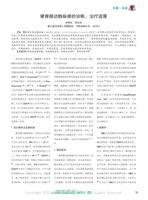 硬脊膜动静脉瘘的诊断、治疗进展