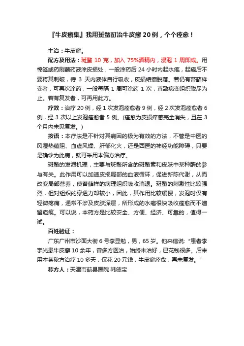 『牛皮癣集』我用斑蝥酊治牛皮癣20例，个个痊愈！