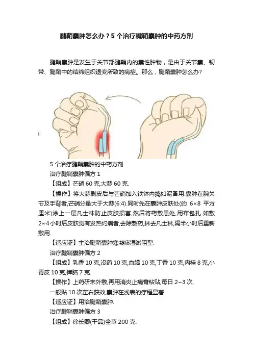 腱鞘囊肿怎么办？5个治疗腱鞘囊肿的中药方剂