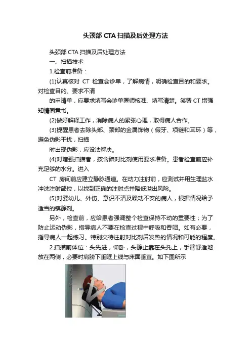 头颈部CTA扫描及后处理方法