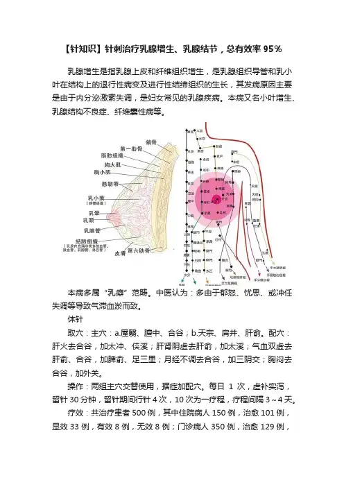 【针知识】针刺治疗乳腺增生、乳腺结节，总有效率95％