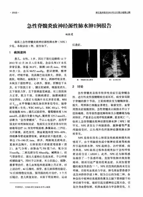 急性脊髓炎致神经源性肺水肿1例报告