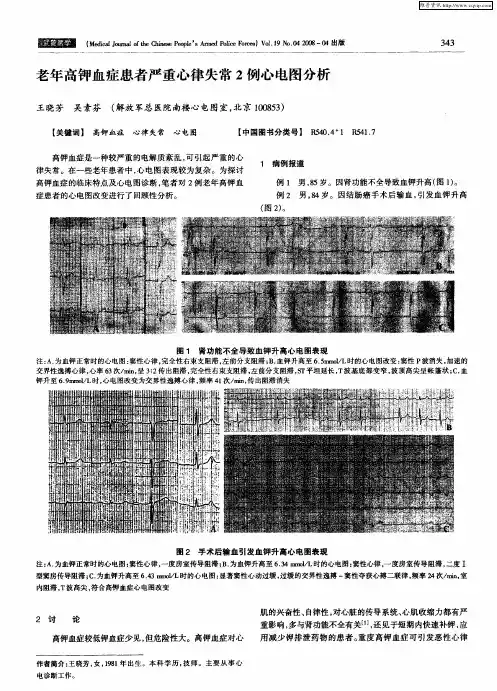 老年高钾血症患者严重心律失常2例心电图分析