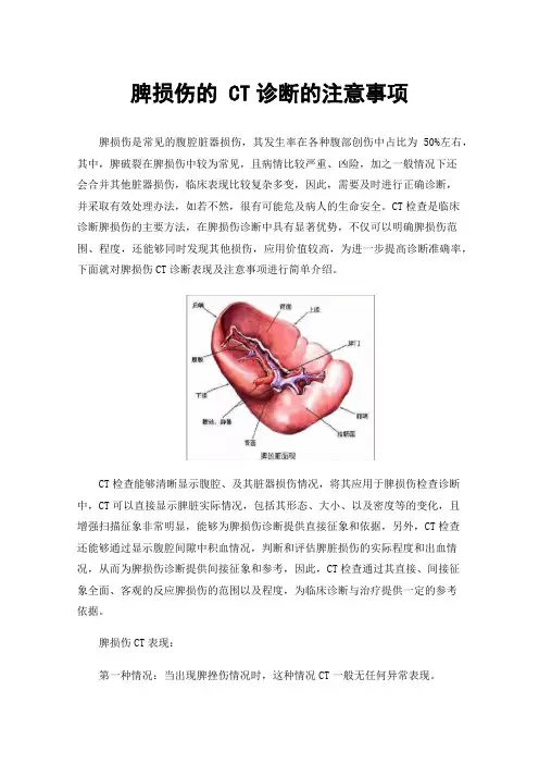 脾损伤的CT诊断的注意事项