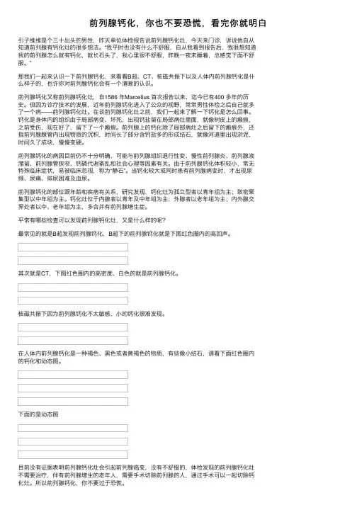 前列腺钙化，你也不要恐慌，看完你就明白
