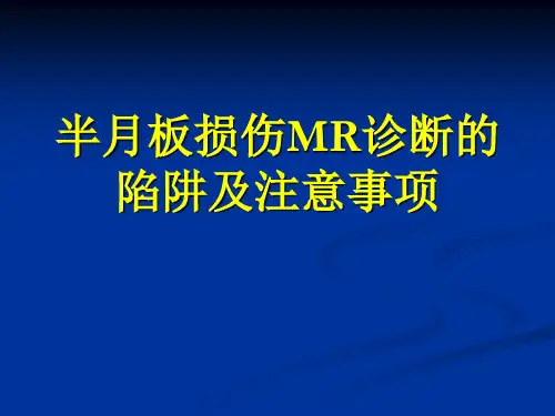 半月板损伤MR诊断注意事项