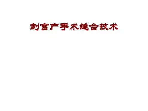 剖宫产手术缝合技术-2022年学习资料