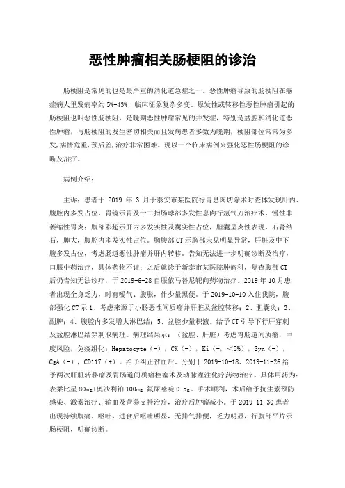 恶性肿瘤相关肠梗阻的诊治