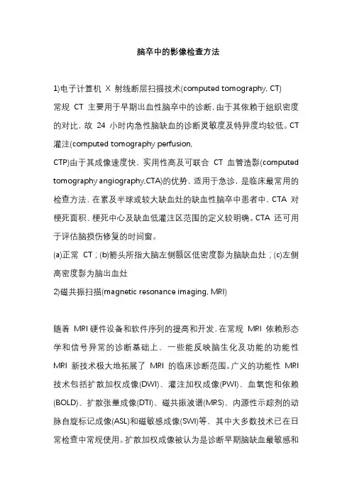 脑卒中的影像检查方法