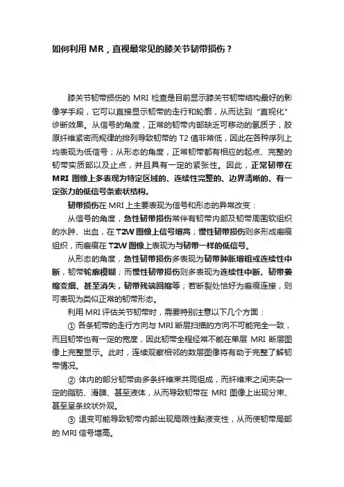 如何利用MR，直视最常见的膝关节韧带损伤？