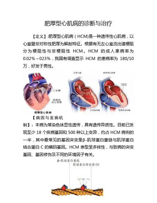 肥厚型心肌病的诊断与治疗