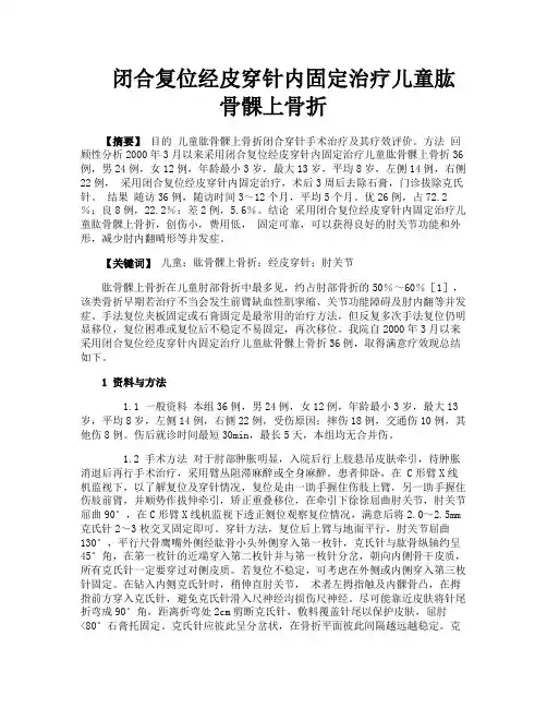 闭合复位经皮穿针内固定治疗儿童肱骨髁上骨折