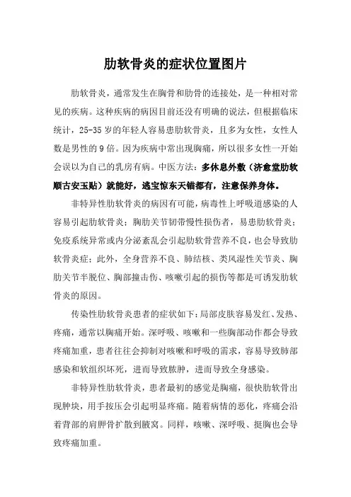 肋软骨炎的症状位置图片