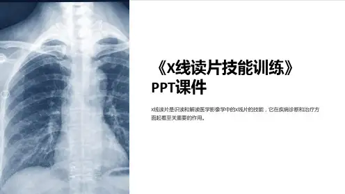 《X线读片技能训练》课件