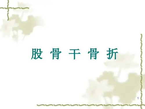 股骨干骨折PPT课件