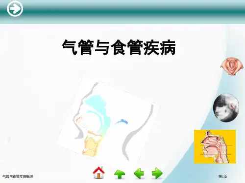 气管与食管疾病概述