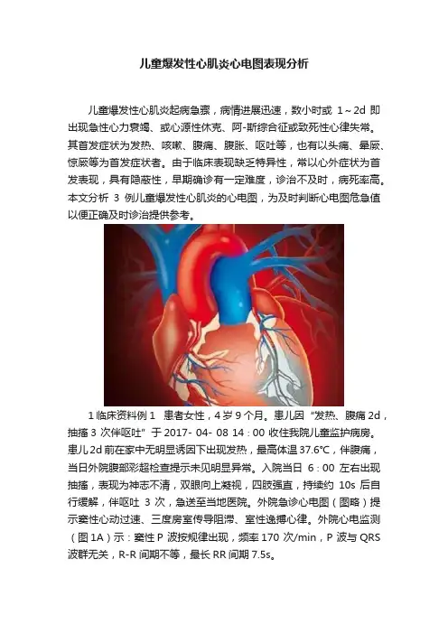 儿童爆发性心肌炎心电图表现分析