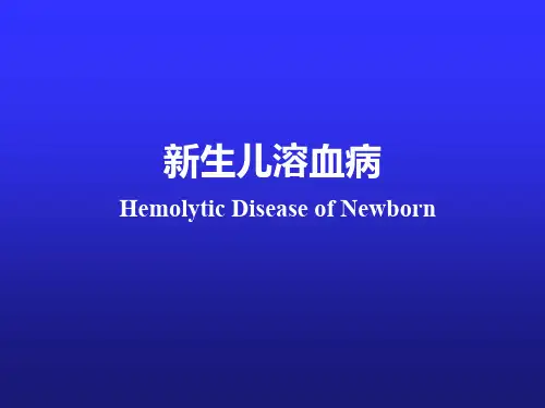 新生儿溶血病ppt课件