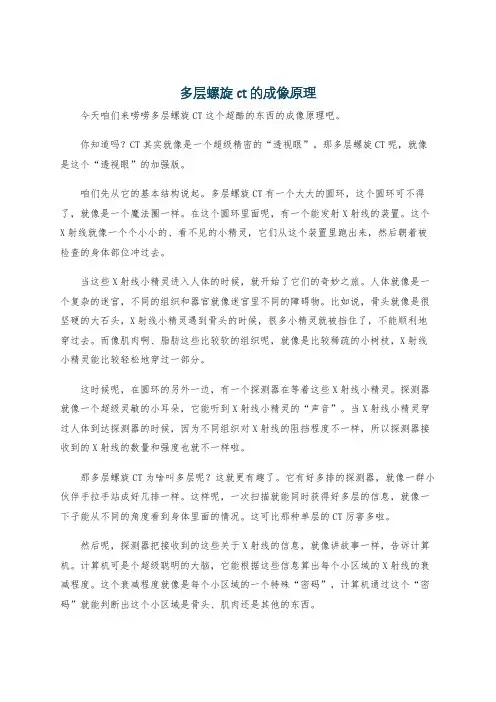 多层螺旋ct的成像原理