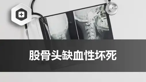 股骨头缺血性坏死-中医骨伤科学骨病课件