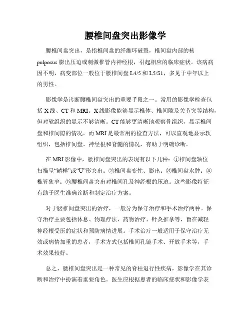 腰椎间盘突出影像学