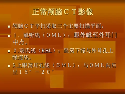 2018年颅脑ct-文档资料-695b439280c1