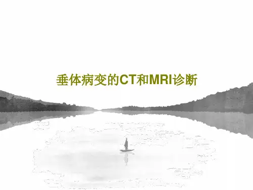 垂体病变的CT和MRI诊断52页PPT