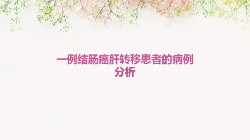 一例结肠癌肝转移患者的病例分析