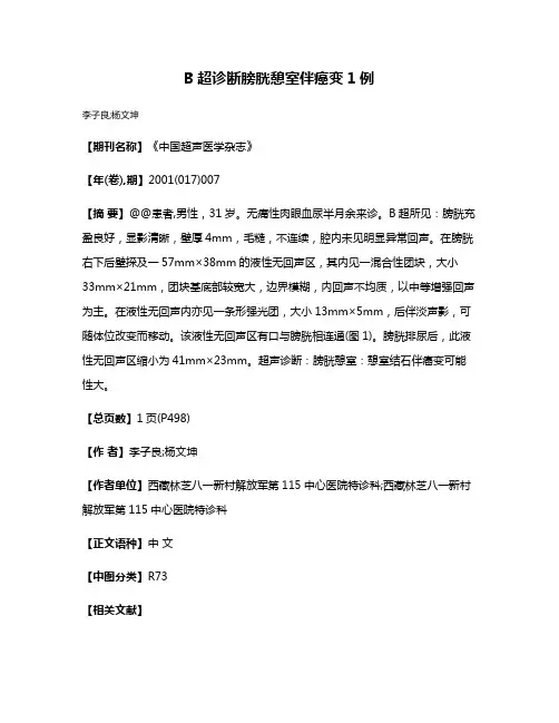 B超诊断膀胱憩室伴癌变1例