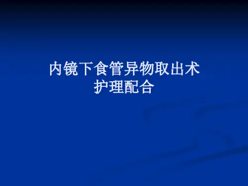 内镜下食管异物取出术