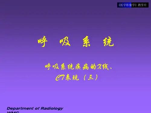 医学影像学05-呼吸系统3课件