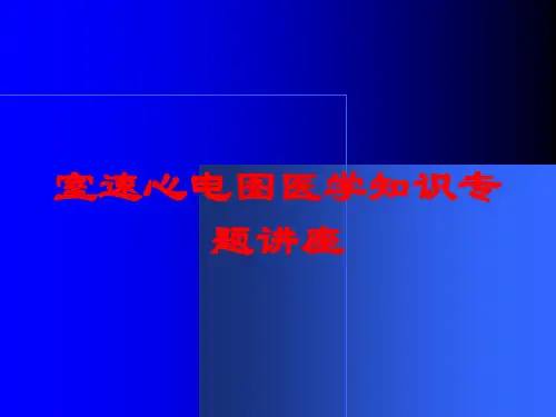 室速心电图医学知识专题讲座培训课件