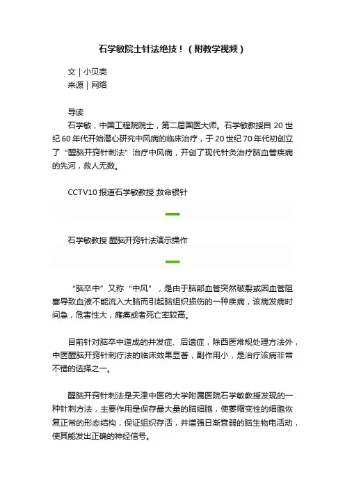 石学敏院士针法绝技！（附教学视频）