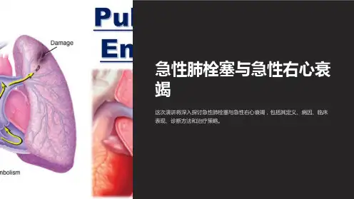 急性肺栓塞与急性右心衰竭