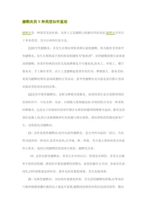 腱鞘炎的5种类型如何鉴别