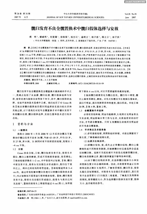 髋臼发育不良全髋置换术中髋臼假体选择与安放