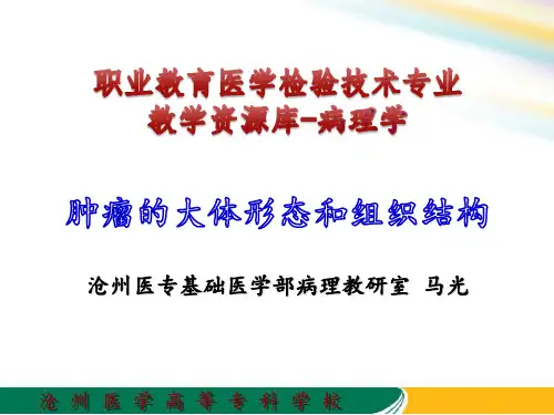 4.2 肿瘤的大体形态和组织结构.